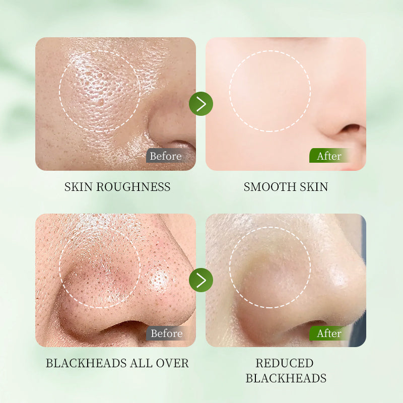 HUNMUI Whitening Exfoliating Gel 50g