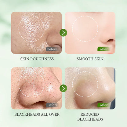 HUNMUI Whitening Exfoliating Gel 50g