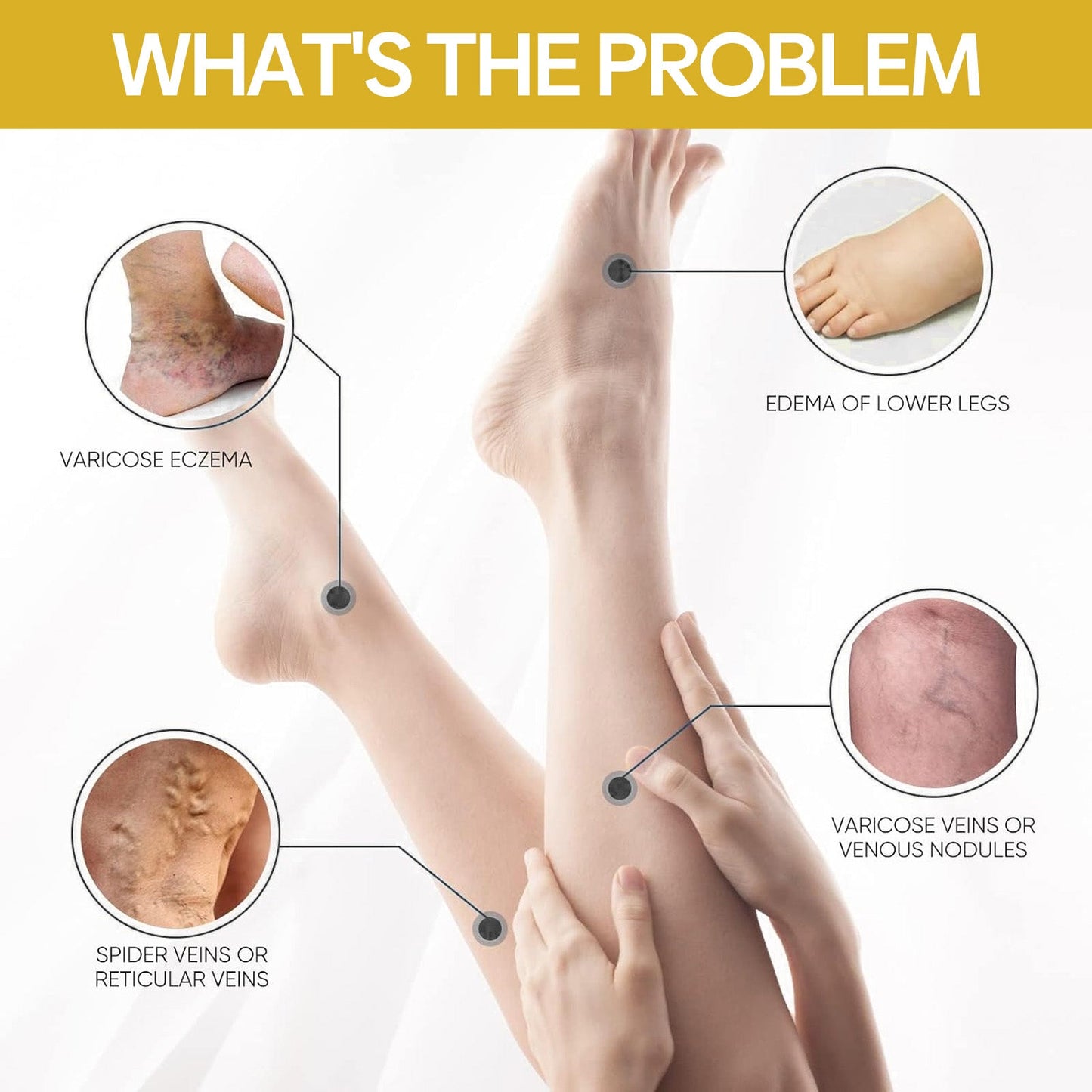 Ximonth Bee Venom Leg Care Cream Relieves Leg Discomfort, Pamper And Moisturize Skin Body Care Cream