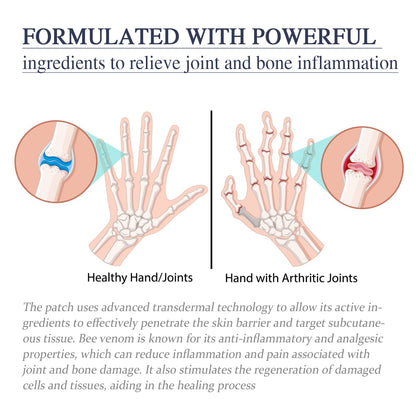 Ximonth Bee Venom Joint Cream, Relieves Hands Legs Bones Knees Lumbar Spine Sedentary Joint Pain Body Care Cream