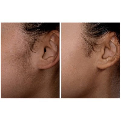 Spa Sciences SIMA Deluxe Sonic Dermaplaning Tool for Exfoliation & Peach Fuzz Removal - Imperfect Box