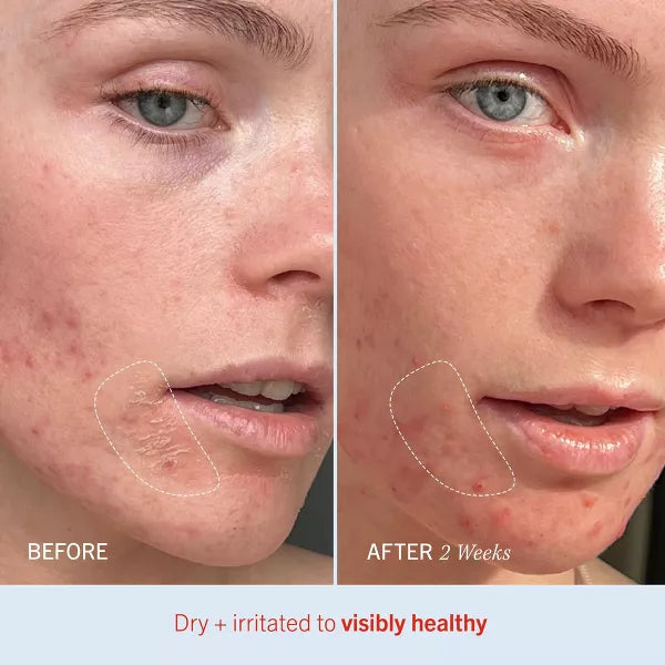 FIRST AID BEAUTY Ultra Repair Cream