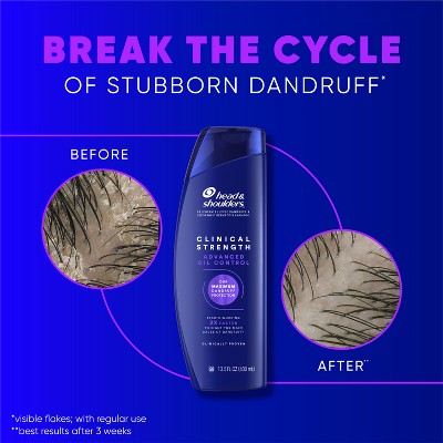 Head & Shoulders Clinical Strength Anti-Dandruff Citrus Shampoo for Advanced Oil Control 13.5 fl oz - Imperfect Container