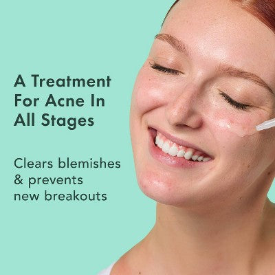 Rael Miracle Clear Complete Acne Treatment Face Serum 1oz - New