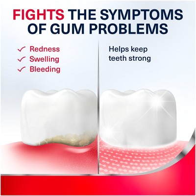 Parodontax Complete Extra Fresh 2pk Toothpaste - Imperfect Box