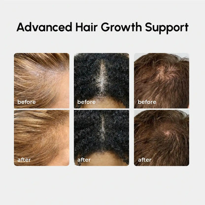 4-in-1 Hair Growth Spray