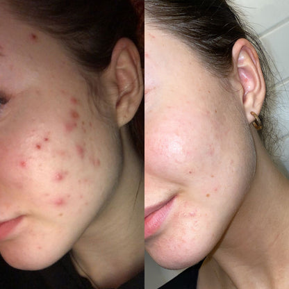It Girl Skin – Ceramide, Hyaluronic Acid & Beauty Gummies for Glowing Skin