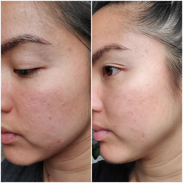It Girl Skin – Ceramide, Hyaluronic Acid & Beauty Gummies for Glowing Skin