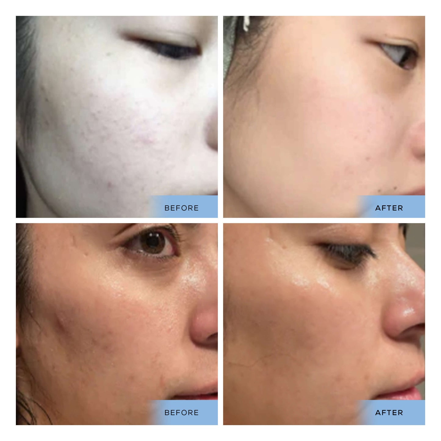 Hyaluronic Acid +Vitamin B5 Serum