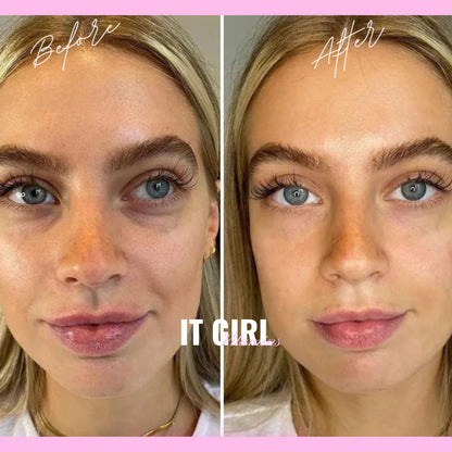 It Girl Skin – Ceramide, Hyaluronic Acid & Beauty Gummies for Glowing Skin