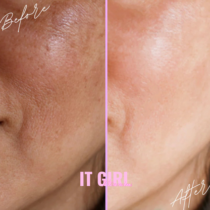 It Girl Skin – Ceramide, Hyaluronic Acid & Beauty Gummies for Glowing Skin