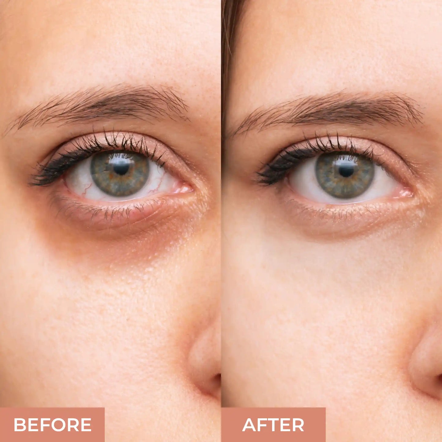 Concealer For Dark Circles
