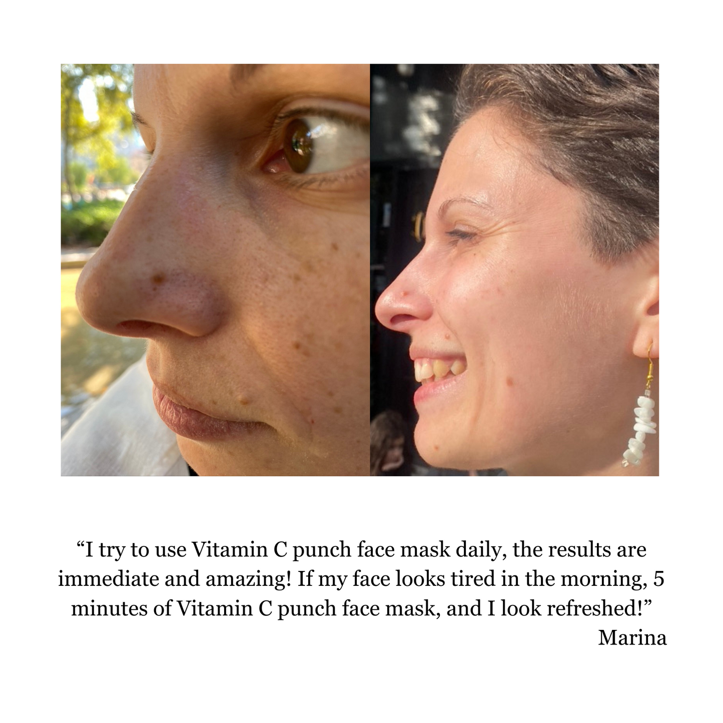 Hyaluron 3D Hydrator Multi Lamellar Emulsion The Advanced Response Face and Neck Cream-Serum