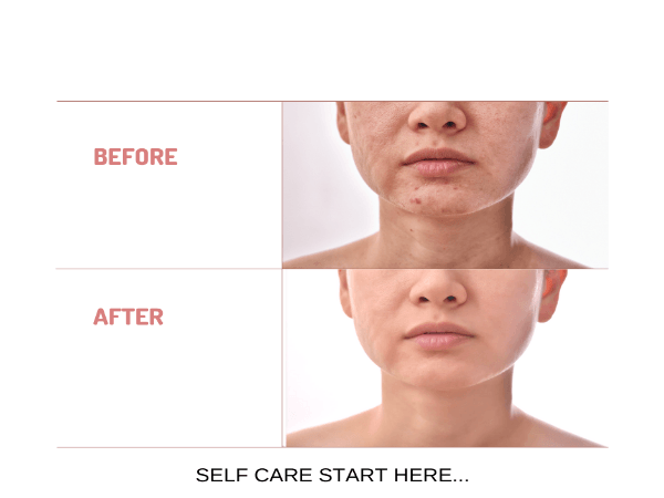 Organic Under Eye Youth Corrector and Neck Renewal Cream Duo - For Women