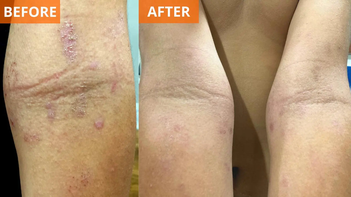 Moisturizing Body Lotion (Shopify Collective)