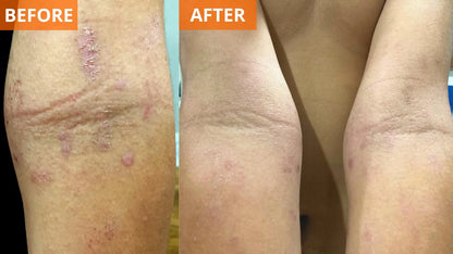 Moisturizing Body Lotion (Shopify Collective)