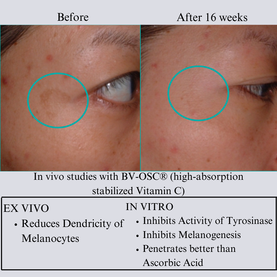 TIGHT AND BRIGHT, an Advanced Gentle Phyto-Retinol and Vitamin C Serum, 12 Innovative Technologies, 55% High-Performance Cosmeceuticals