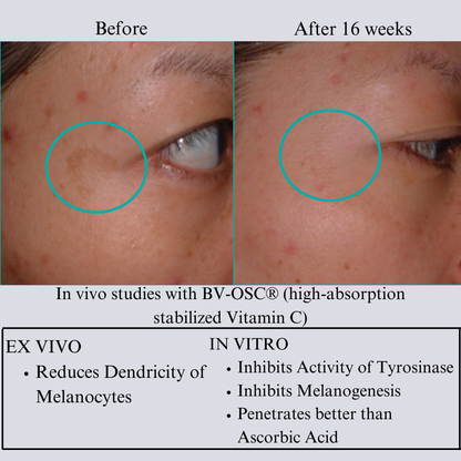 TIGHT AND BRIGHT, an Advanced Gentle Phyto-Retinol and Vitamin C Serum, 12 Innovative Technologies, 55% High-Performance Cosmeceuticals