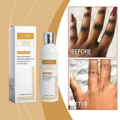 OUHOE Facial Cleansing Lotion, Moisturizing Cleansing Lotion, Refreshing Hydrating Oil Control Nourishing Facial Skin Cleansing Lotion