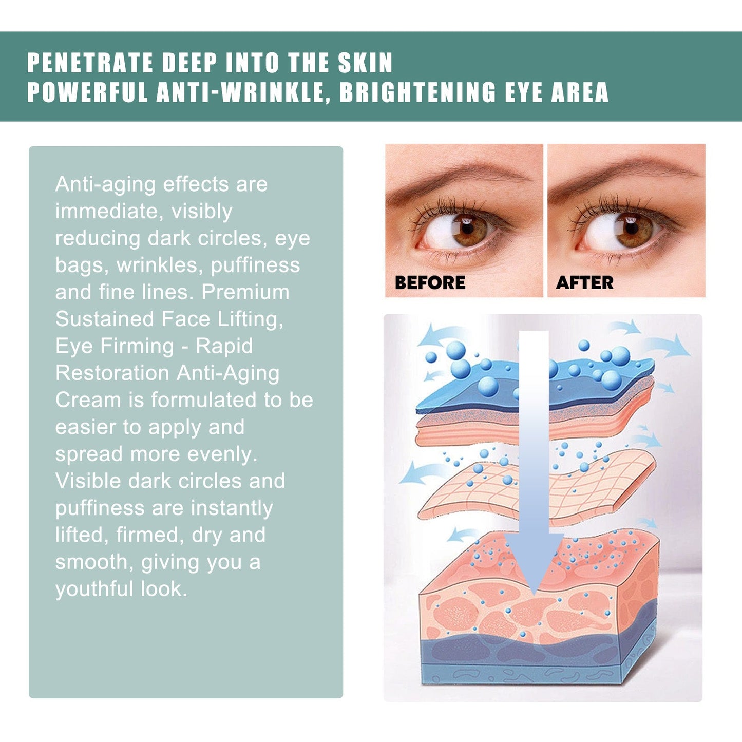 EELHOE Anti-Wrinkle Eye Cream Protects The Skin Around The Eyes And Reduces Dark Spots, Dry Lines And Fine Lines