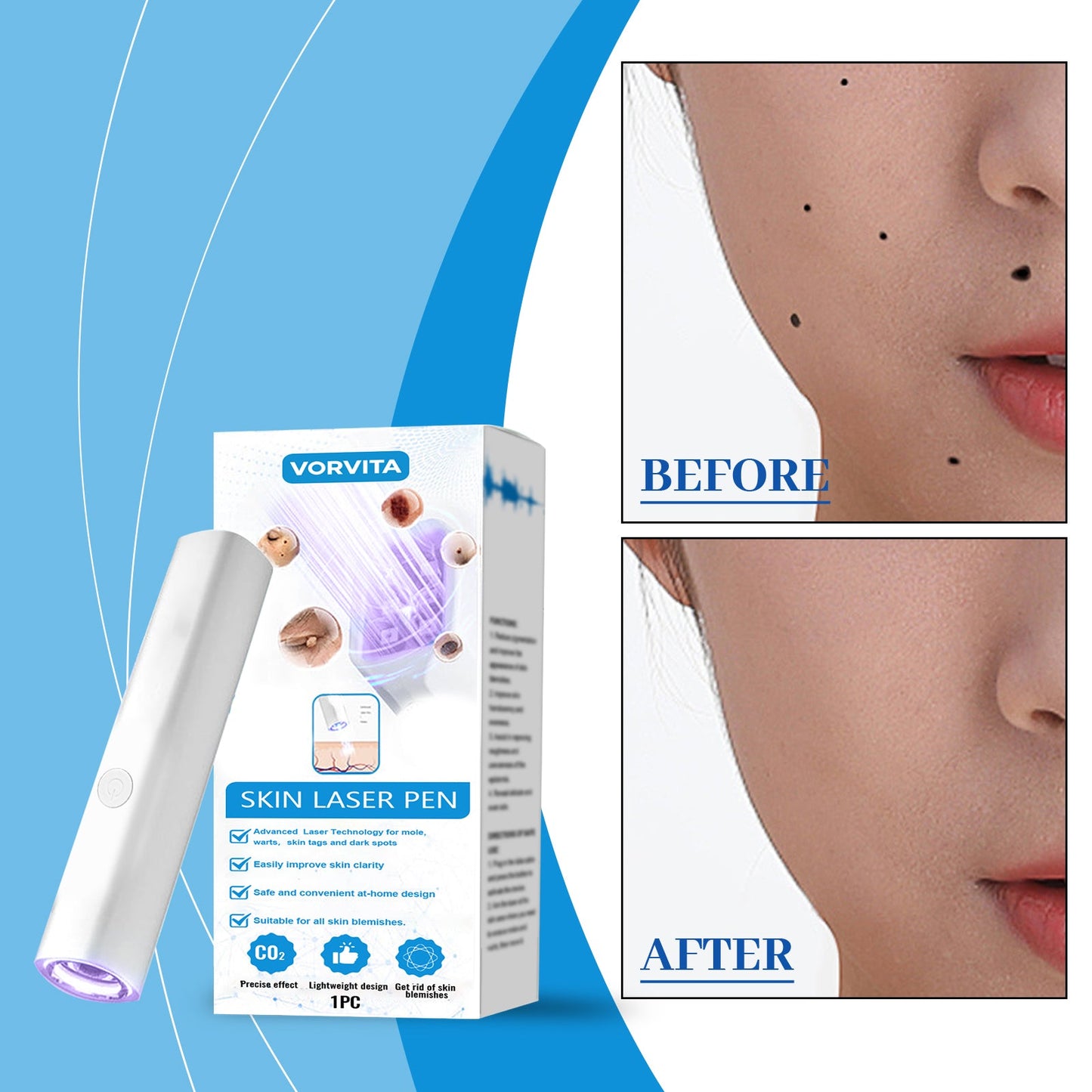Skin Laser Pen 1pc