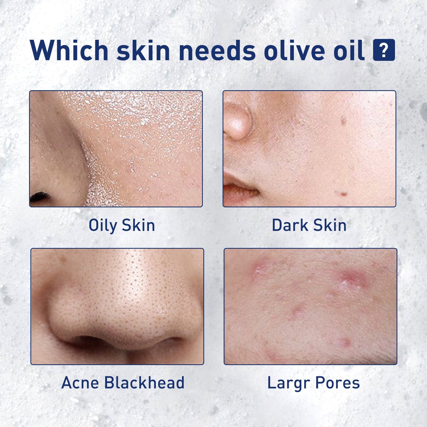 West&Month Exfoliating Mousse, Cleanser Skin Pore Control Oil Gently Cleanses Exfoliating Dead Blackheads