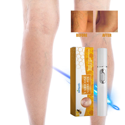 Leg Soothing Laser Pen 1pcs