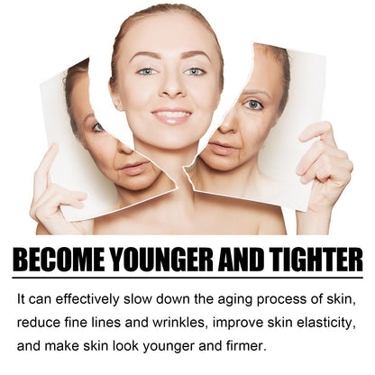 OUHOE TCA Acid Skin Peel Serum