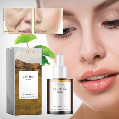 EELHOE Centella Serum, Intensive Moisturizing Improve Dry Skin Smooth And Tender Skin Brighten Hydrating Essence
