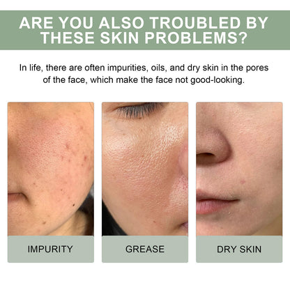 Hoygi Pore Deep Cleansing Foam, Deep Clean Facial Skin Shine Bright Moist Blain To Imprint Clear Water