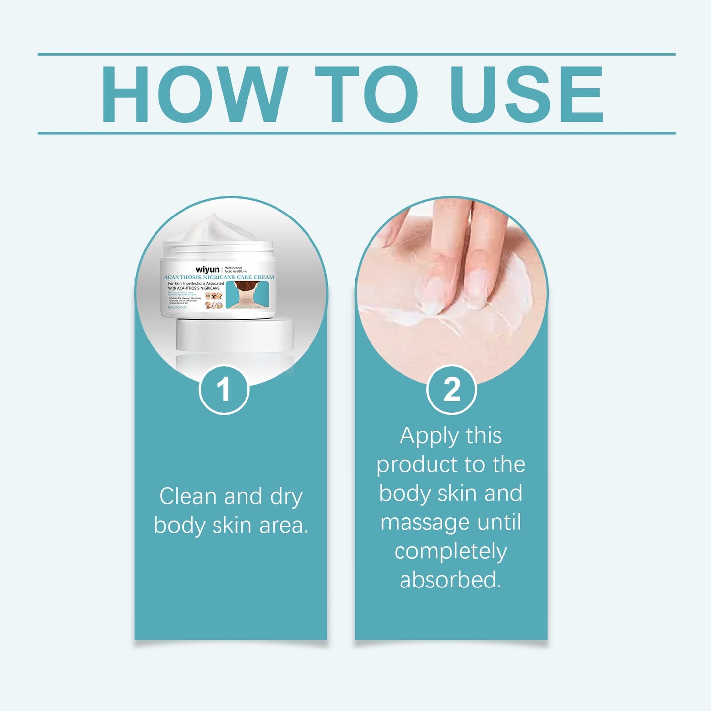 Wiyun Acanthoderma Nigricans Care Cream Soft Moist, Hydrating, Refreshing And Improving Dry And Tender Skin Body Care Cream