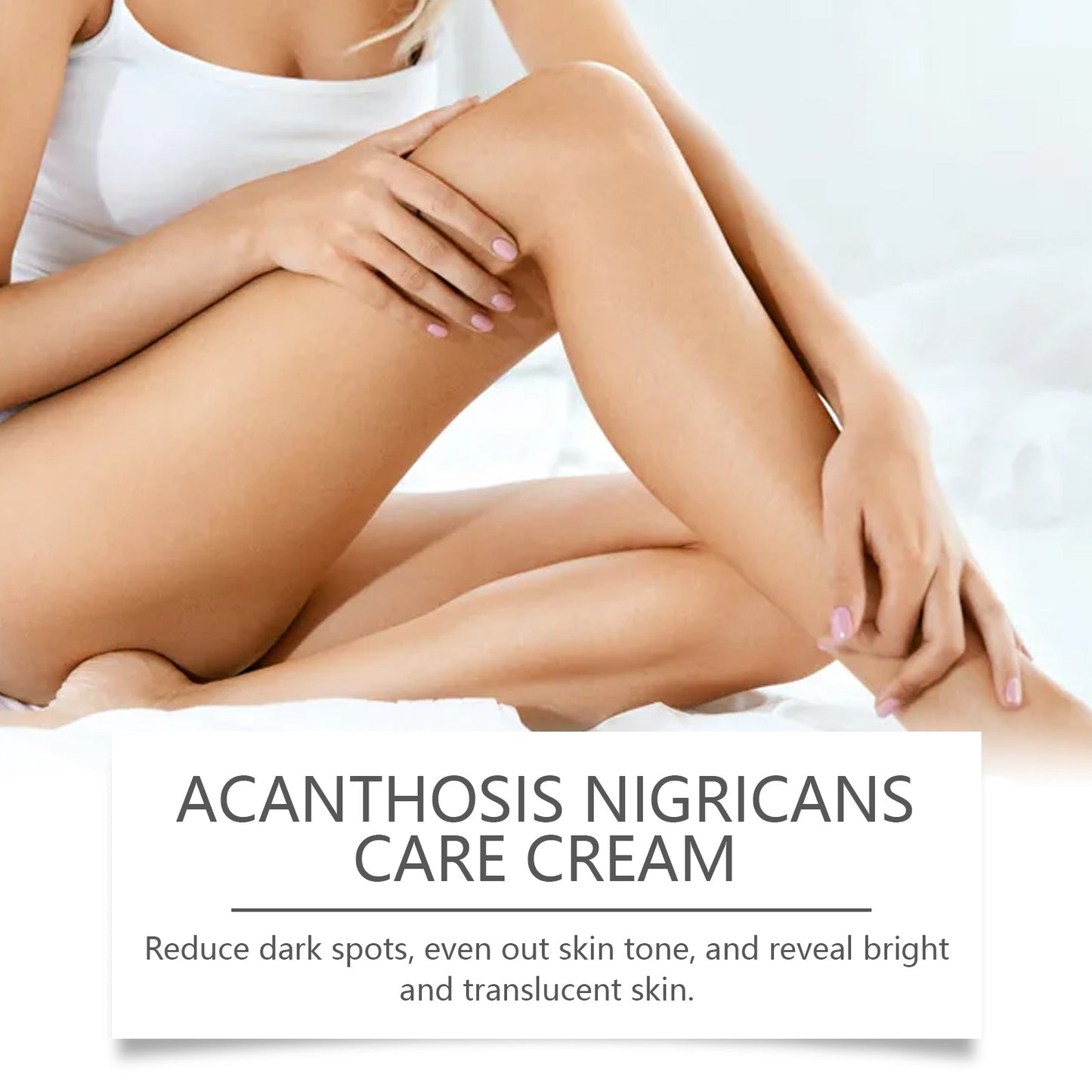 Wiyun Acanthoderma Nigricans Care Cream Soft Moist, Hydrating, Refreshing And Improving Dry And Tender Skin Body Care Cream