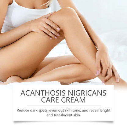 Wiyun Acanthoderma Nigricans Care Cream Soft Moist, Hydrating, Refreshing And Improving Dry And Tender Skin Body Care Cream