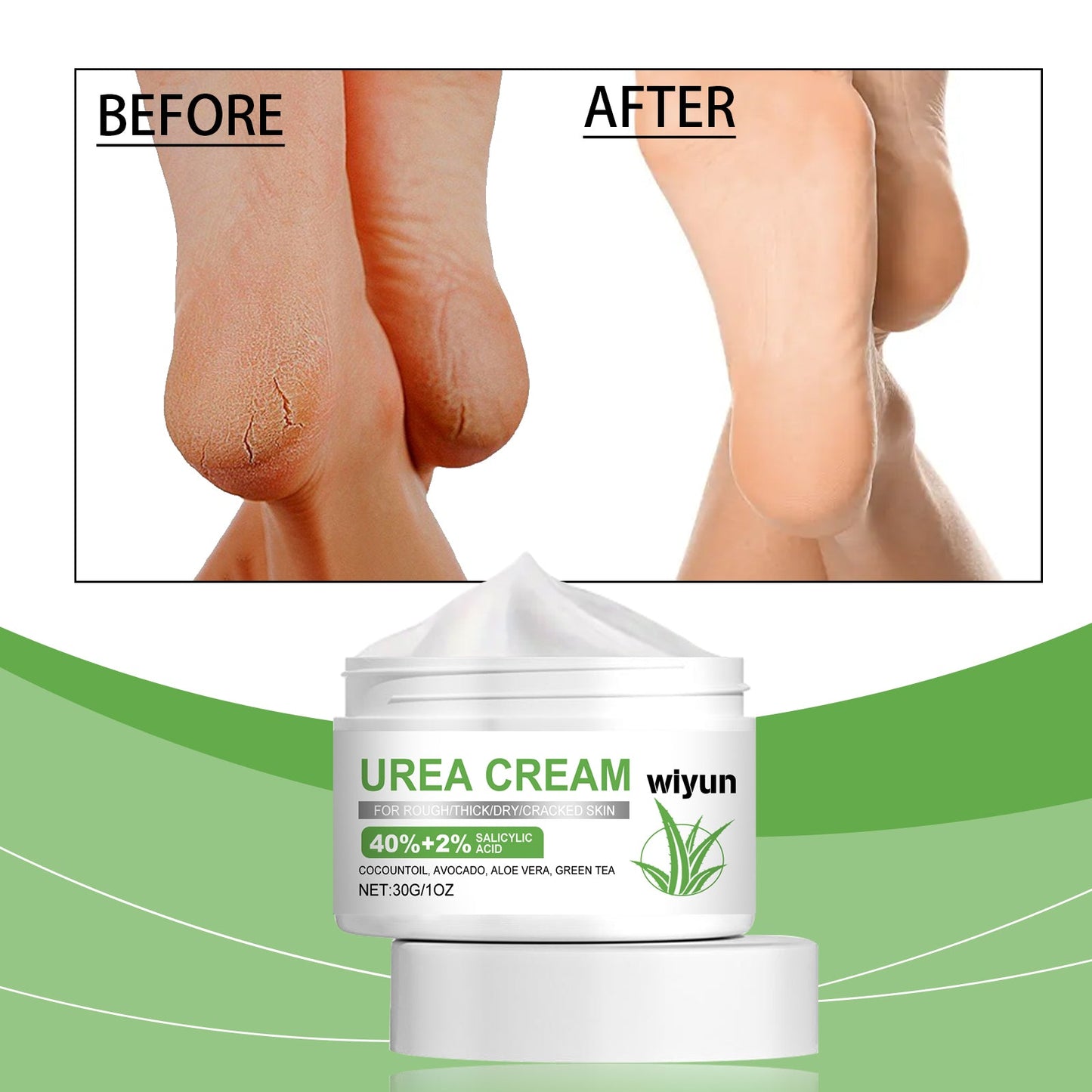 Foot Urea Care Cream