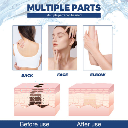 Jaysuing Spot Body Cleanser, Face Body Cleansing Skin Fade Spot Whitening Beauty Skin Cream