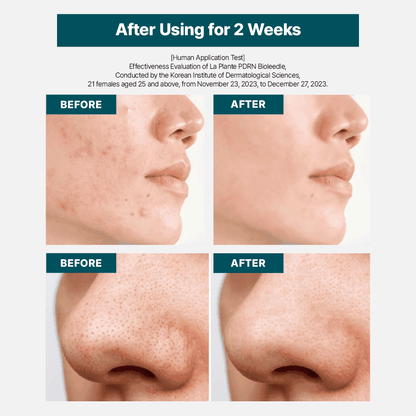 [Bundle] La Plante PDRN Bioleedle Serum, 50ml / 1.69fl. oz. x 2box