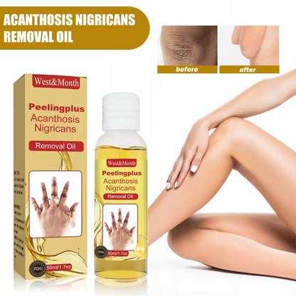 West&Month Acanthosis Nigricans Removal Oil, Exfoliating Light Black Brightening And Beauty Skin Oil