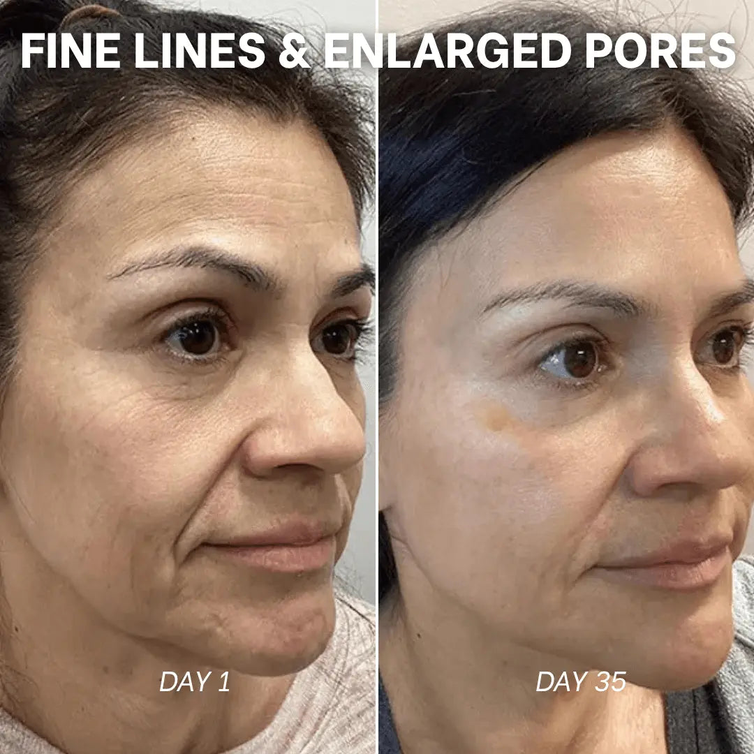 PDRN Collagen Peptide Hydrogel Mask