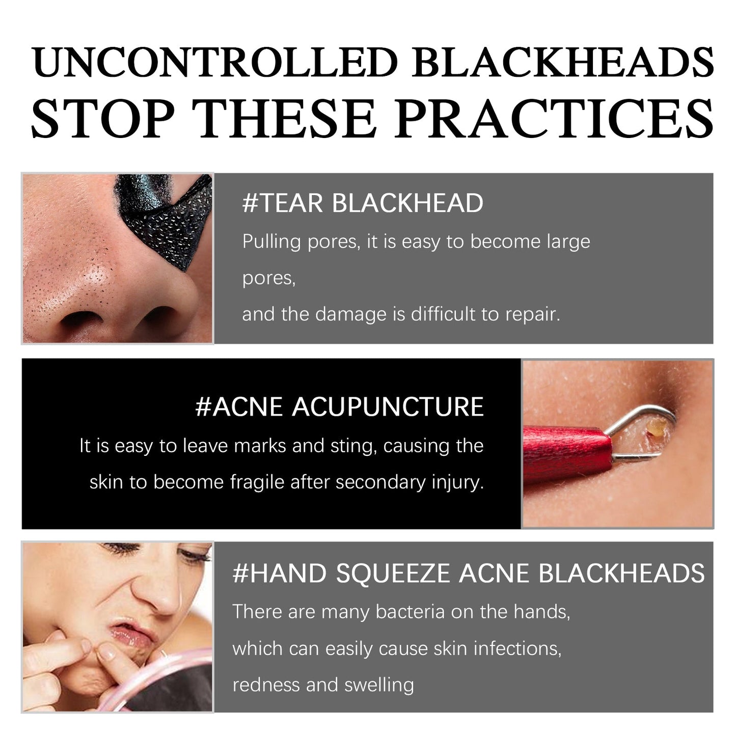 EELHOE Blackhead Removal Mask Cleanses Blackheads, Lighens Pimples, Tighteners Pores And Controls Oil Smear Mask