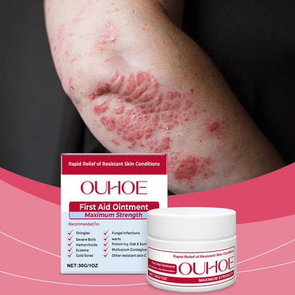 OUHOE Skin Soothing Cream, To Relieve Skin Redness And Discomfort Gentle Care Moisturizes Skin Topical Soothing Cream