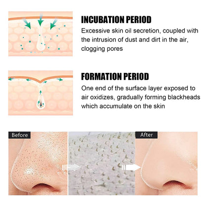 EELHOE Blackhead Remover Nose Mask, Deeply Cleans And Closes Pore Blackheads And Acne Barbs And Nose Remover Mask