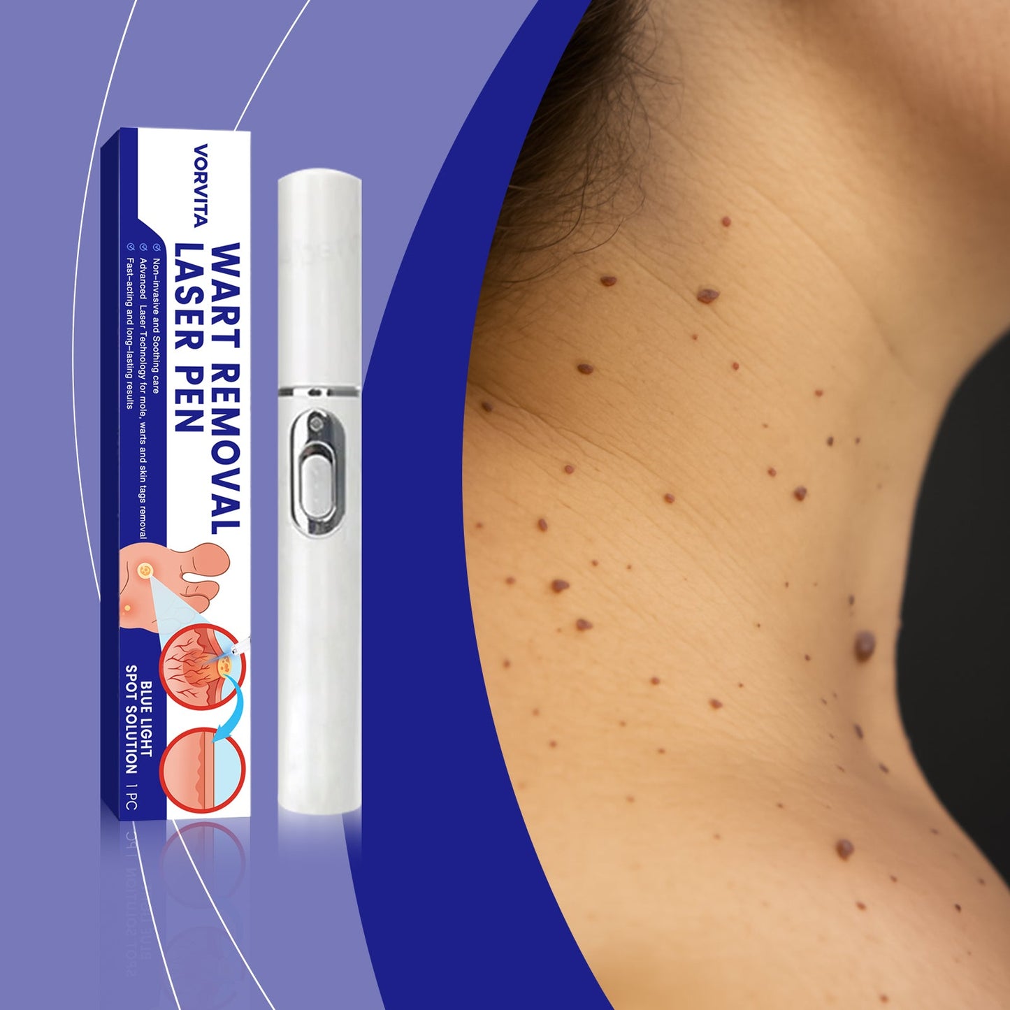 Skin Laser Care Pen 1pc