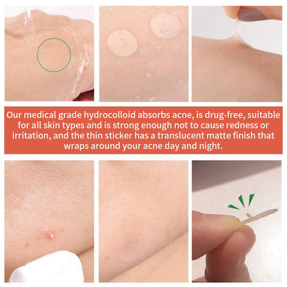 72 Count Acne Scar Patch,Nighttime Spot Stickers For Face And Skin,Shrinking Zits And Whiteheads