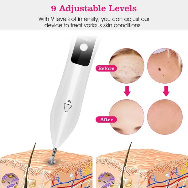 Skin Tag Repair Kit Portable Beauty Equipment Multi-Level With Home Usage USB Charging LCD Level Adjustable 6 Replaceable Needles