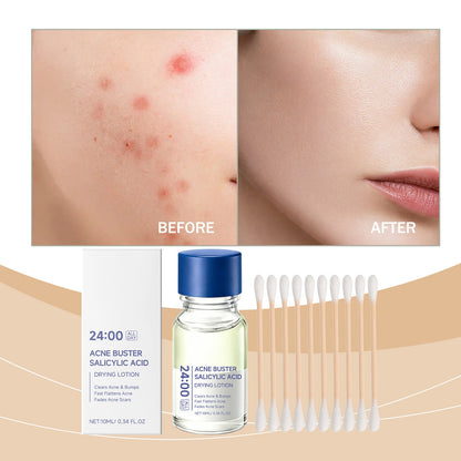 Clear And Moisturizing Skincare Lotion 1set