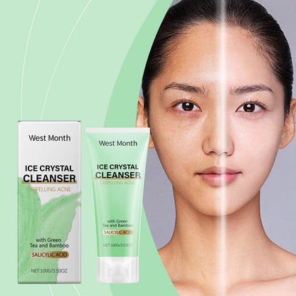 West&Month Anti-Acne Cleanser, Gently Cleanses Pores Refreshing, Non-Tight, Moisturizing And Hydrating