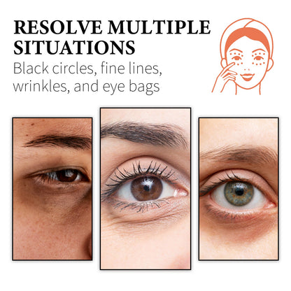 WIYUN Retinol & Collagen Moisturizer Eye Cream, Lightening Dark Circles And Bags Under Eyes Moisturizing Firming Care Multi-Effect Eye Cream