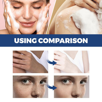 Jaysuing Spot Body Cleanser, Face Body Cleansing Skin Fade Spot Whitening Beauty Skin Cream