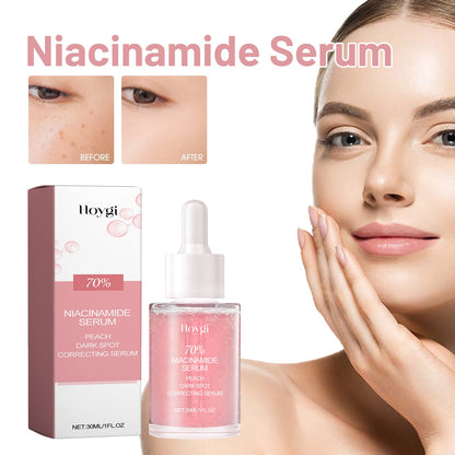 Hoygi Nicotinamide Serum Hydrates, Improves Dark, Translucent Pores, And Brighens Facial Hydrating Muscles
