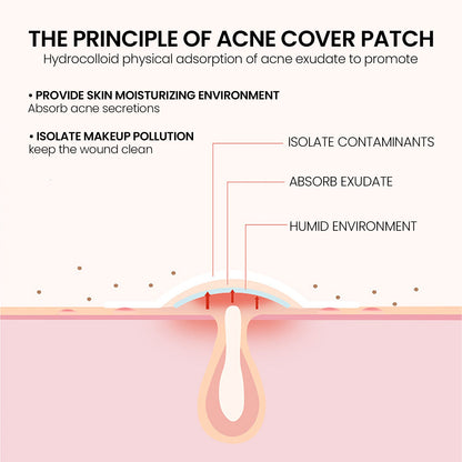 Repair Acne Patch,200patches